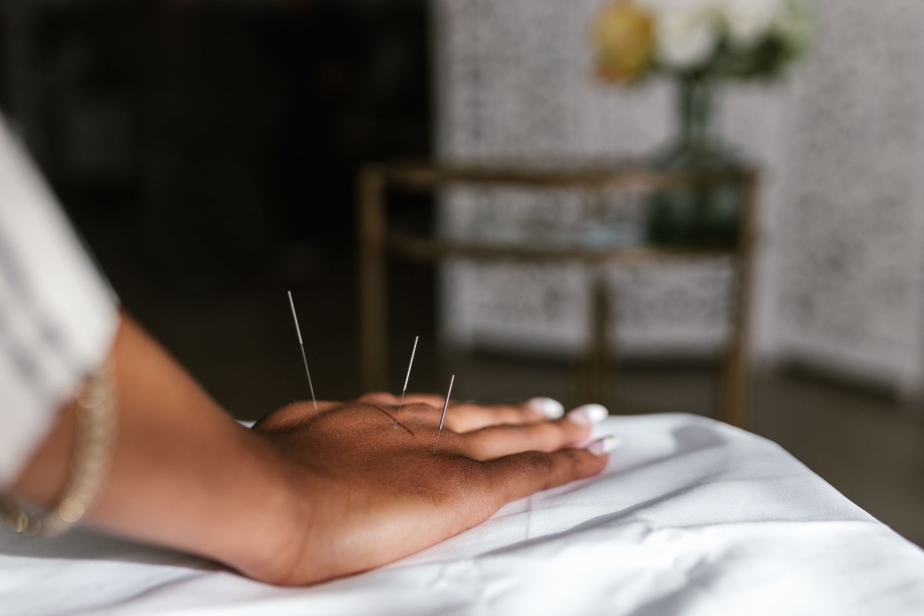 Acupuncture at Sayantika Wellness Centre
